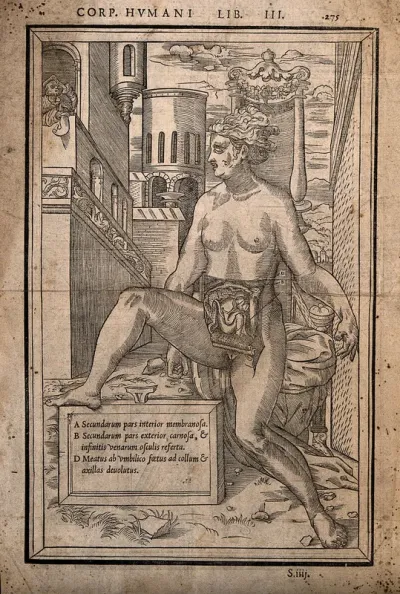 Dissection of the abdomen of a pregnant woman, showing the foetus: the nude woman is shown seated on a canopied chair in an outdoor setting, while a man with spectacles gazes from a balcony