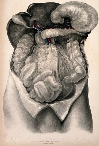 Dissection of the abdomen showing the lymphatic vessels