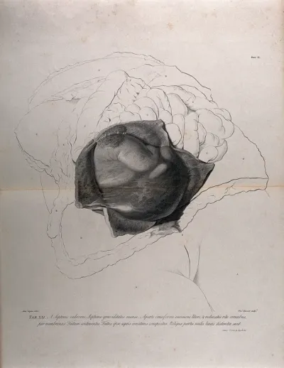 Dissection of the female abdomen, showing part of the pregnant uterus at seven months, with the surrounding viscera