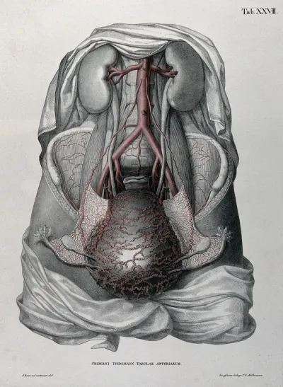 Dissection of the female abdomen, showing the kidneys, gravid (?) uterus, ovaries and fallopian tubes, with the arteries and blood vessels indicated in red