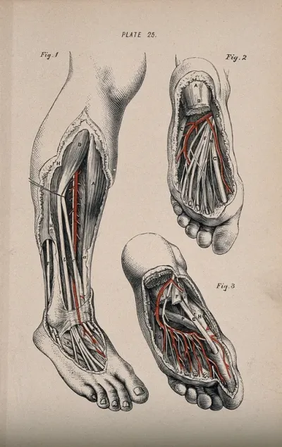 Dissection of the foot and lower leg: three figures, showing the tendons, muscles and blood vessels