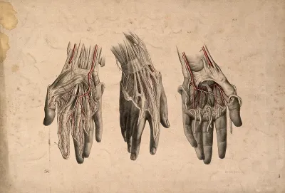Dissection of the hand: three figures