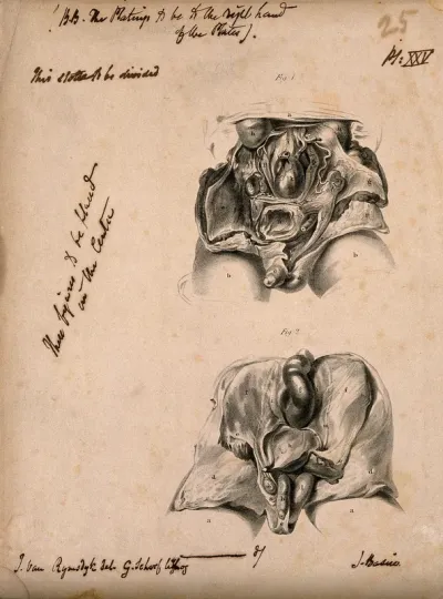 Dissection of the male abdomen: two figures