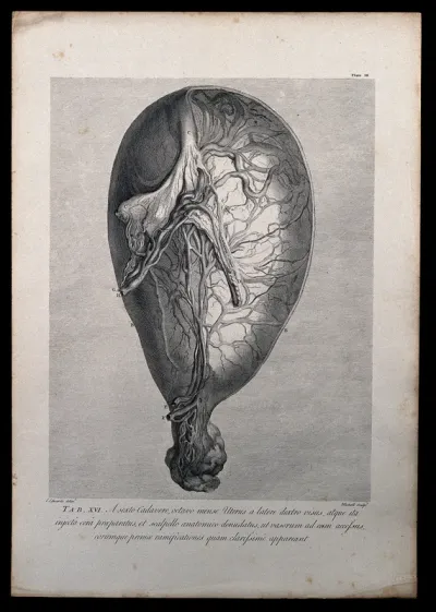 Dissection of the pregnant uterus and eight months, showing the uterine vessels