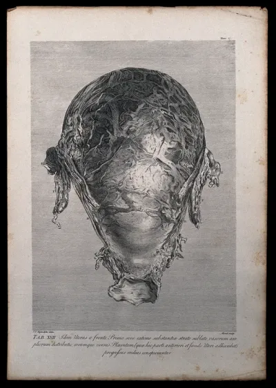 Dissection of the pregnant uterus at eight months, showing the distribution of the larger uterine vessels