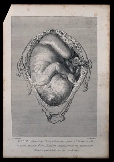 Dissection of the pregnant uterus, showing the foetus at eight months, with the head positioned towards the vagina