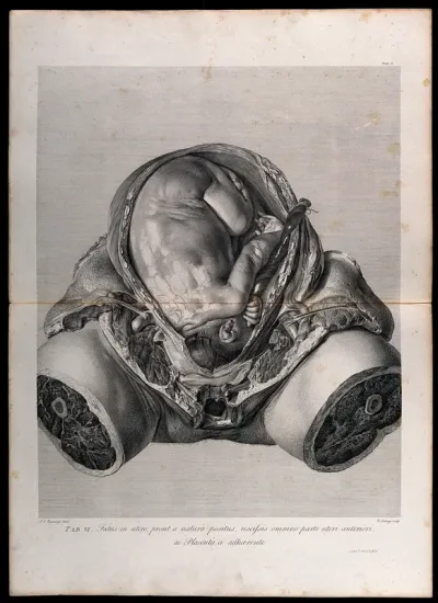 Dissection of the pregnant uterus, showing the foetus at nine months