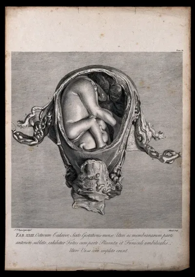 Dissection of the pregnant uterus, showing the foetus at six months