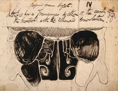 Dissection of the skull and nasal cavities