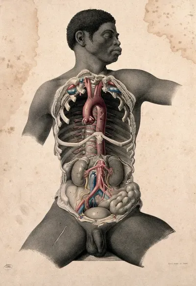 Dissection of the trunk of a seated black man, showing major blood-vessels