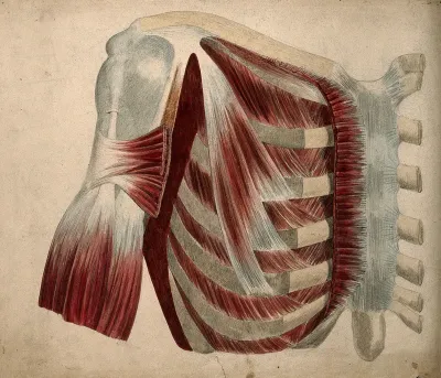 Dissection showing the muscles and bones of the chest and shoulder
