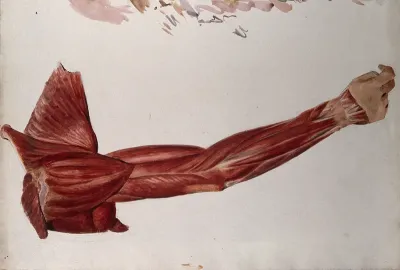 Dissection showing the muscles of the arm and shoulder, back view