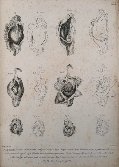 Dissections of abortions of around eight and nine weeks: six figures, each with an accompanying line diagram