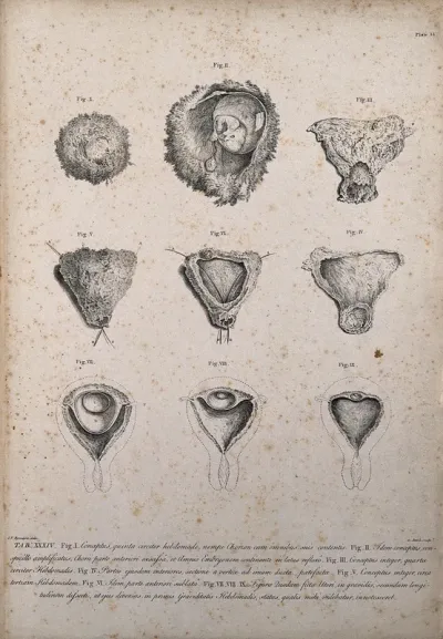 Dissections of chorions during the early stages of pregnancy: nine figures