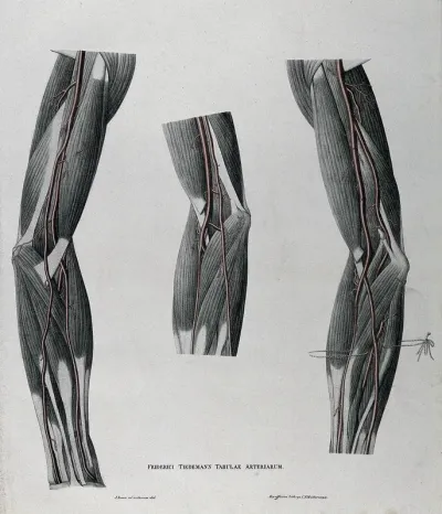 Dissections of the arm and elbow; three figures, with the arteries and blood vessels indicated in red