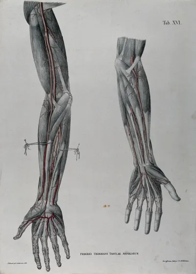 Dissections of the arm and hand; two figures, with the arteries and blood vessels indicated in red