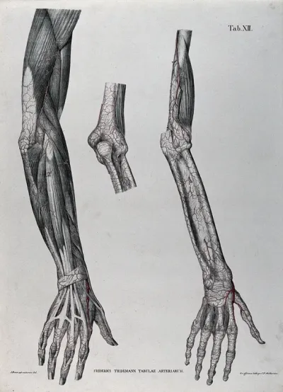 Dissections of the arm, hand and elbow joint; three figures, with the blood vessels indicated in red