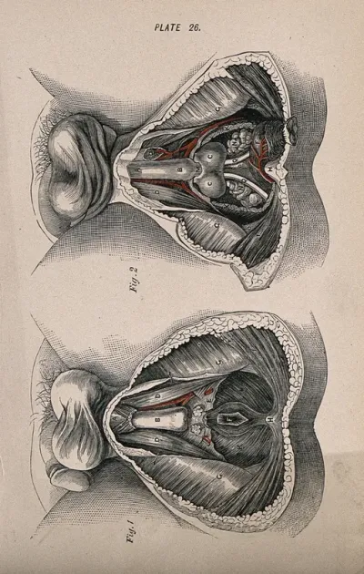 Dissections of the male genital and rectal area: two figures