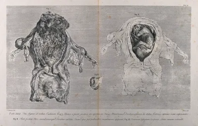 Dissections of the pregnant uterus and the corpus luteum in the left overy, at five months: three figures