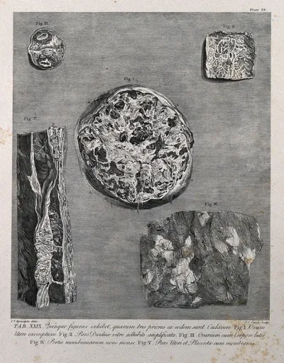 Dissections showing parts of the pregnant uterus, decidua and ovum at nine months: five figures