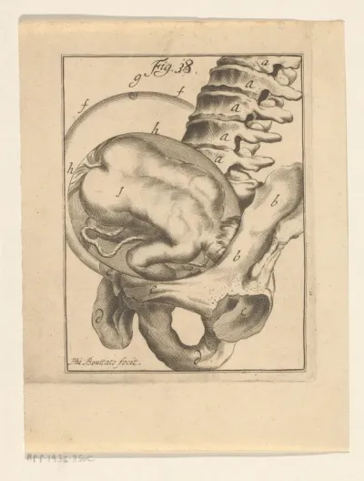 Dwarsligging van een foetus