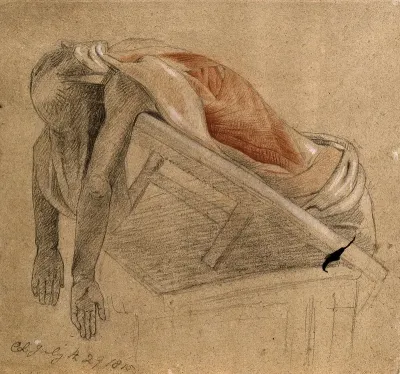 Écorché cadaver resting on tilted support, seen from below, with arms hanging down, with the muscles of the trunk indicated