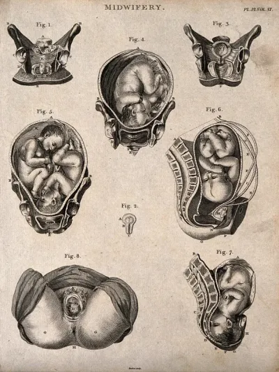Eight diagrams illustrating babies in the womb and internal structures of the womb
