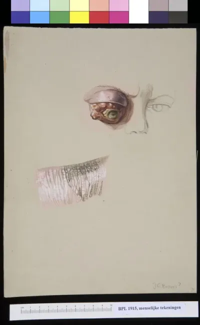 Eye