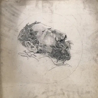 Face of a dead (?) man suffering from syphilis, showing a severely diseased nose