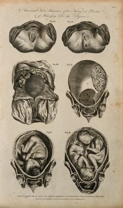 Female genitalia and uterus during pregnancy: six figures, including cross-sections of foetus and twins in utero