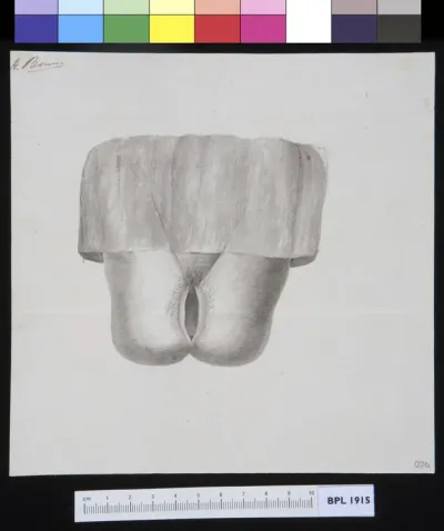 Female genitals