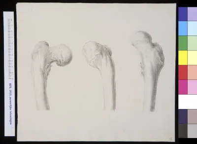 Femur (thigh bone)