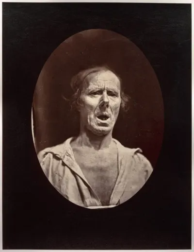 Figure 54: Abaissement volontaire de la mâchoire inférieure: mouvement inexpressif