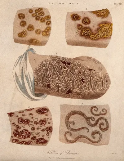 Five patches of skin showing types of skin disease