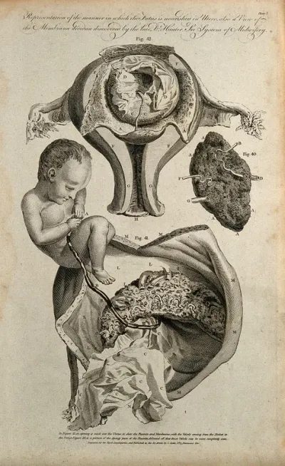 Foetus, uterus and placenta: three figures demonstrating the nourishment of the foetus in utero