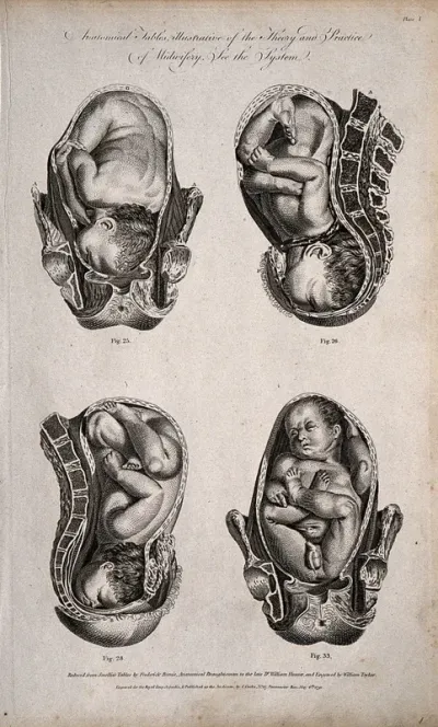 Four babies in different delivery positions in the womb