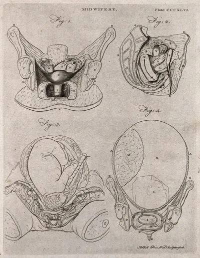 Four cross-sections of figures of the pregnant uterus