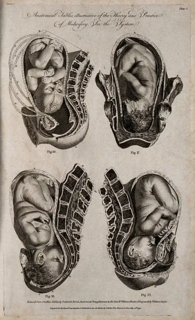 Four diagrams of babies in the womb