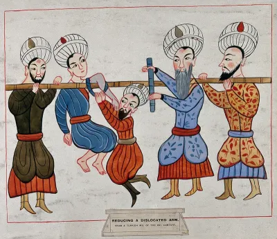 Four Turkish men are reducing a man's dislocated shoulder