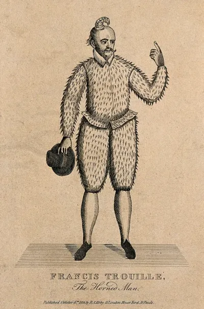 François Trouille, a man with a horn growing from his head