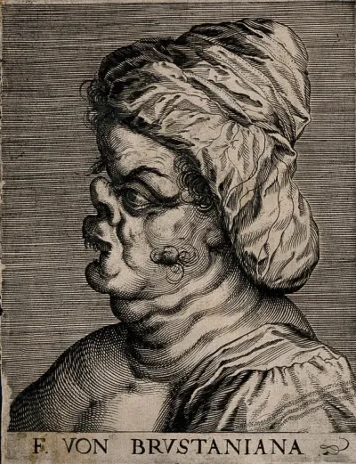 Frau von Brustaniana, a character with a grotesque face