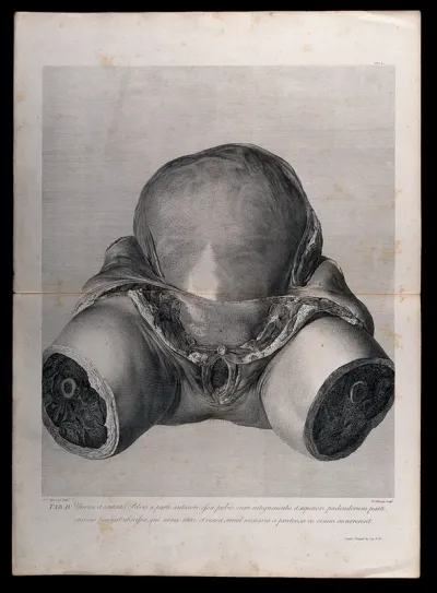 Front view of the pregnant uterus and pelvic area, showing the skin peeled away to reveal the swollen womb