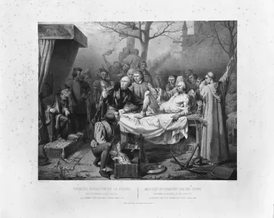 Germain Colot performing an operation for bladder stone