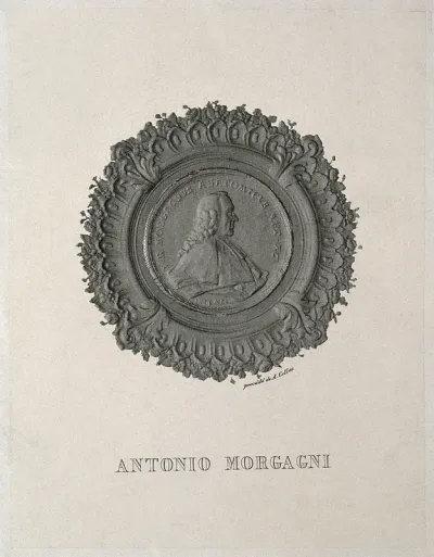 Giovanni Battista Morgagni