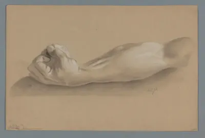 Gipsmodel van een arm met gebalde vuist