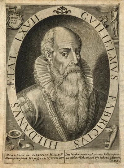 Guglielmus Fabricius of Hilden