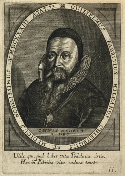 Guglielmus Fabricius (Wilhelm Fabry) of Hilden
