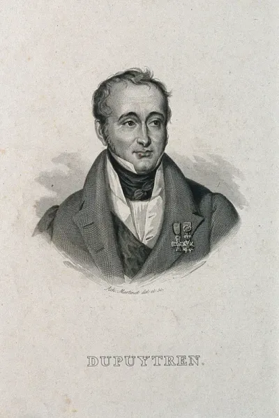 Guillaume, Baron Dupuytren