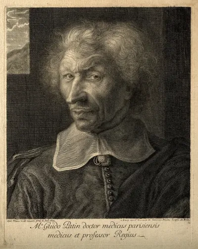 Guy Patin. Line engraving by A. Masson, 1670, after himself