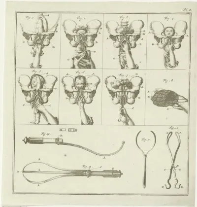 Gynaecologische voorstellingen